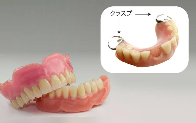 入れ歯（義歯）の制作